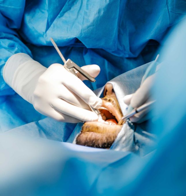 Formation implantologie chirurgie Initiale
