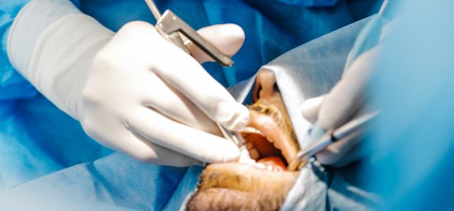 Formation implantologie chirurgie axe et cible