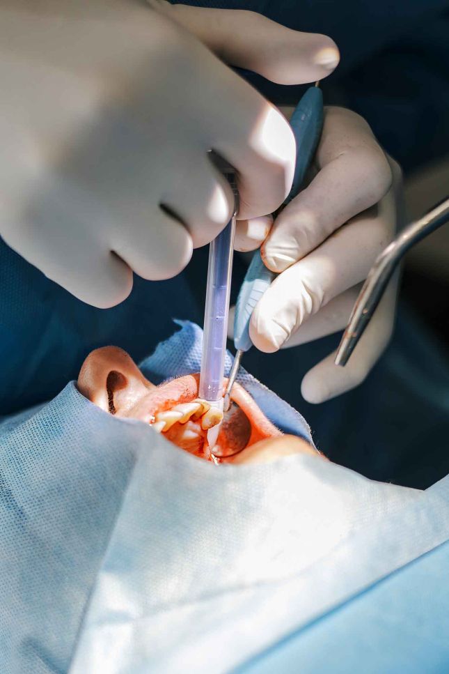 Formation implantologie chirurgie avancée Axe et cible Montpellier